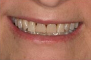 Before Treatment Image 02