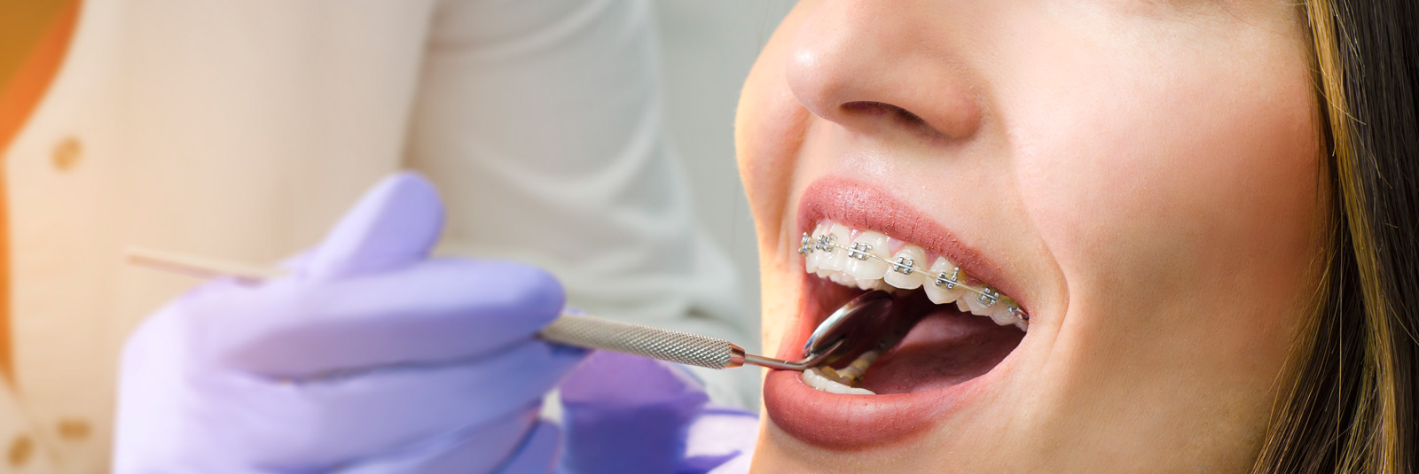 Beautiful girl with dental braces
