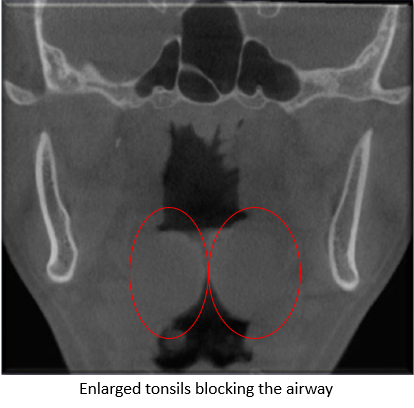 Dental X-ray 1