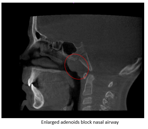Dental X-ray 2