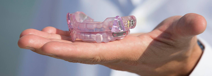 Somnodent (Mandibular Advancement Appliance)