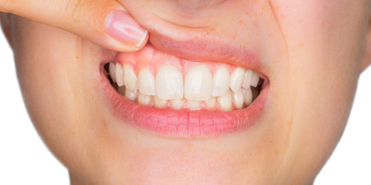 young woman showing her teeth