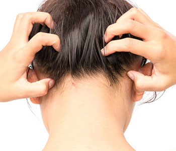 What is Acne Keloidalis Nuchae?