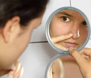 Houston specialists tailor effective treatment to type of acne scarring