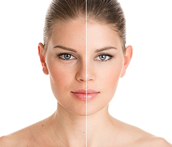 Solutions from a Katy dermatologist help fight aging skin and wrinkles