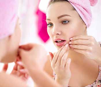 Using microdermabrasion for acne conditions in Katy