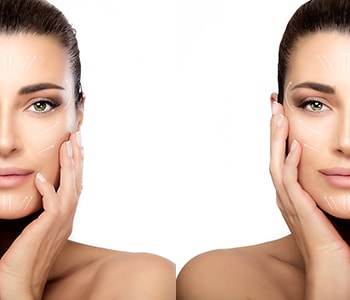 Banishing age spots with individualized treatment in Katy, TX