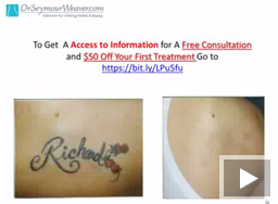 Laser Tatoo Removal , Houston TX
