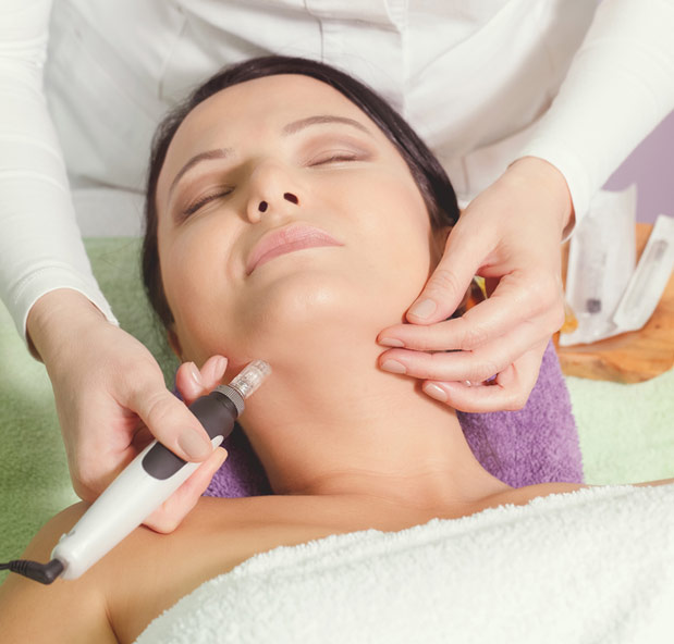Microneedling