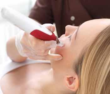 What are the benefits of using microneedling treatment for skin rejuvenation in Houston, TX?