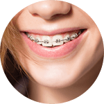 Orthodontics