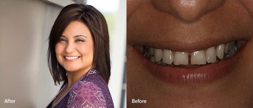 Before After 10
