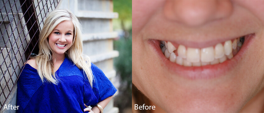 Before After 06