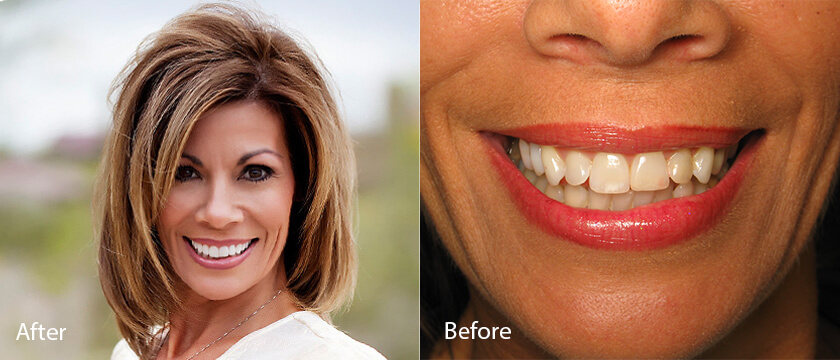 Before After 08