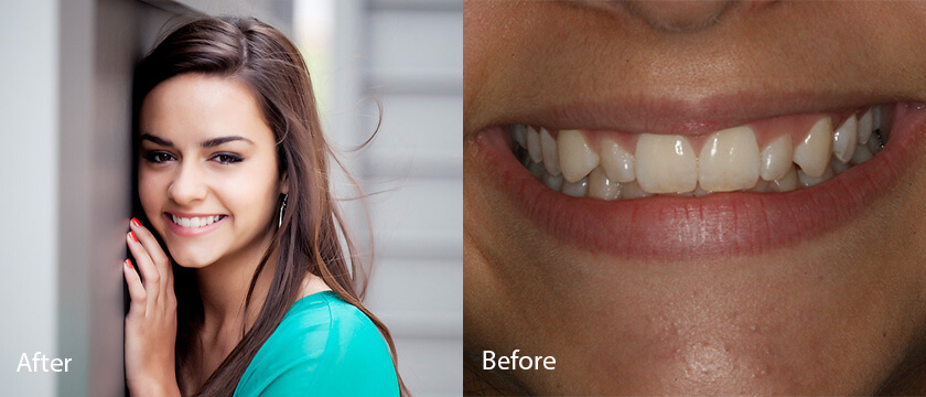 Before After 09
