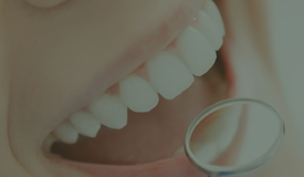 Teeth Whitening