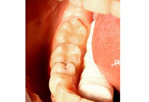 Patient After Image 04