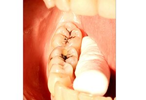 Patient Before Image 04