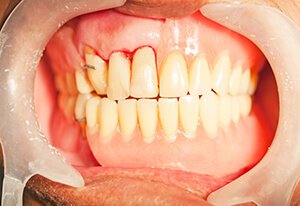 Patient After Image 03