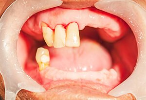 Patient Before Image 03