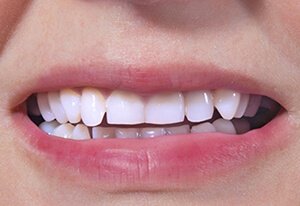 Patient After Image 01