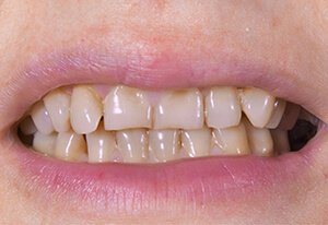  Patient Before Image 01