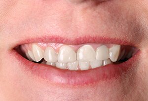 Patient After Image 02