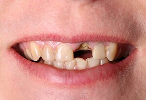 Patient Before Image 02