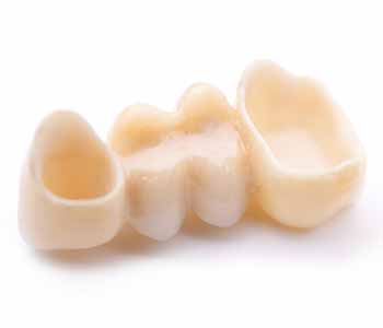 Modern dental crowns in Citrus Heights
