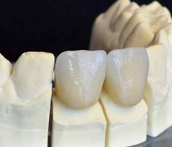 healthy way to restore smiles in Citrus Heights