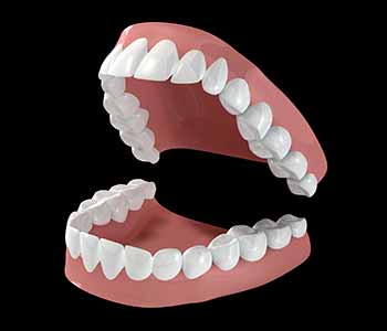 Dental crowns have been around for a long time. 