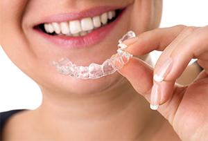 An attractive smile include brightness and proper positioning