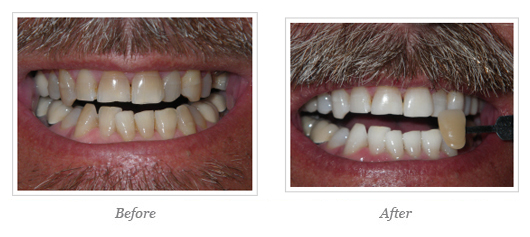 Kor Whitening Before After 13