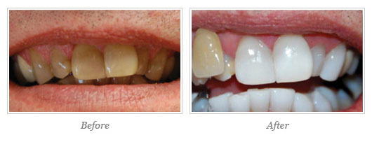 Kor Whitening Before After 05
