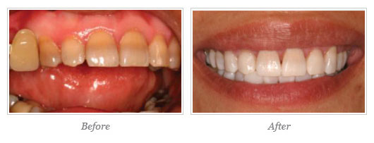 Kor Whitening Before After 06