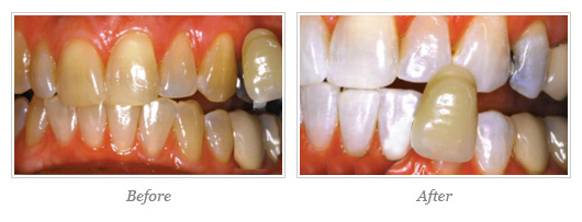 Kor Whitening Before After 09