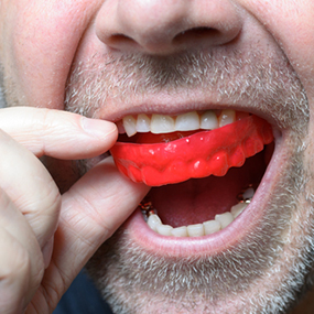 Man with mouthguard