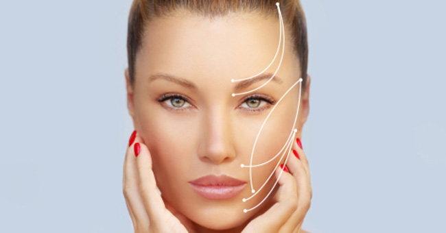 What You Need to Know about Thread Lifts in Plano area