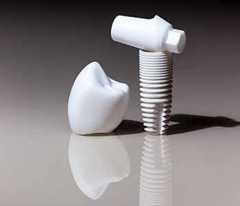 Dental implants are the new and improved solution for missing teeth.