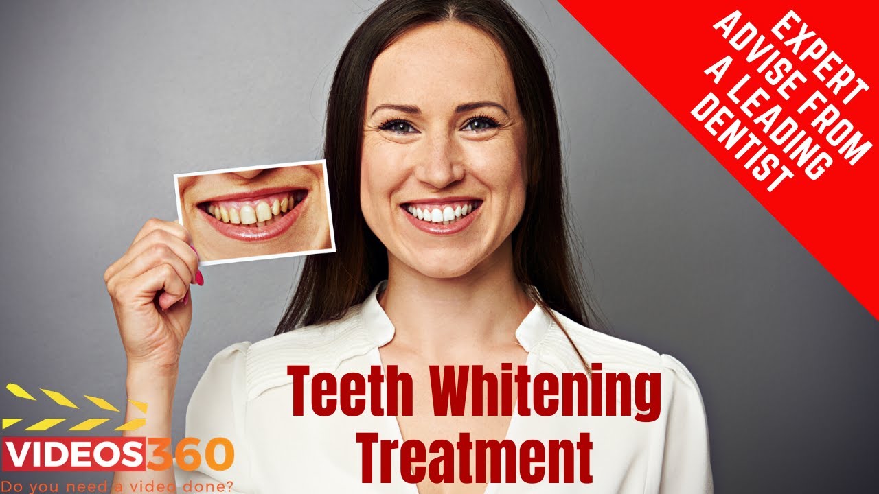 Teeth Whitening Treatment explained Dr. Terry Rose