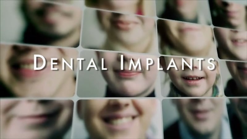 Dental Implants Introduction