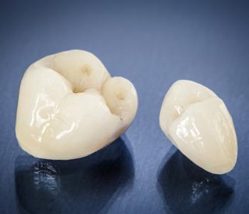 What is the process for obtaining crowns for teeth?