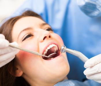 Composite Resin Dental Fillings from Dentist in Mississauga ON