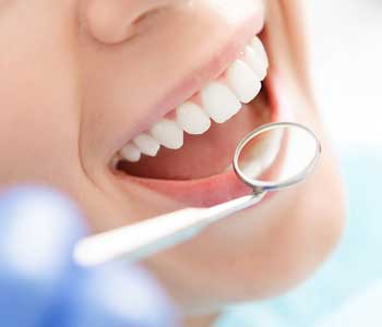 What are the side effects of tooth extractions in Mississauga?