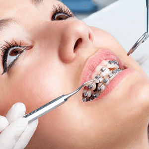 Orthodontics Mississauga